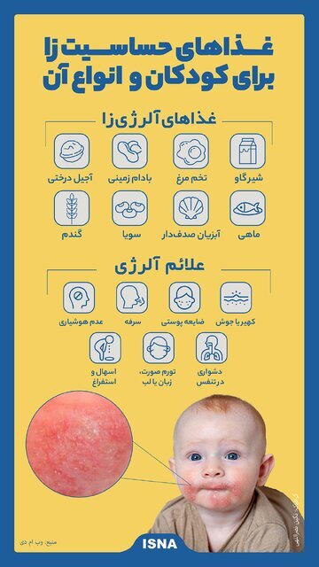 اینفوگرافیک / غذاهای حساسیت زا برای کودکان و انواع آن اینفوگرافیک / غذاهای حساسیت زا برای کودکان و انواع آن