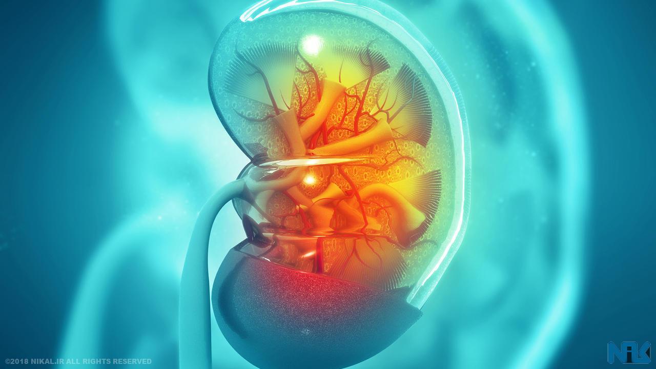 بیماریهای مزمن کلیوی خاموشِ دردسرساز