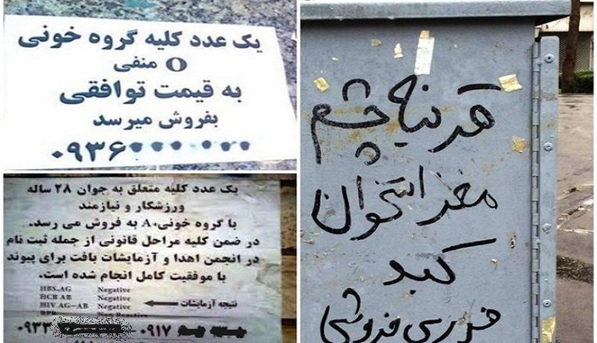 عکس| خرید‌وفروش اعضای بدن در ایران آزاد شد؟!