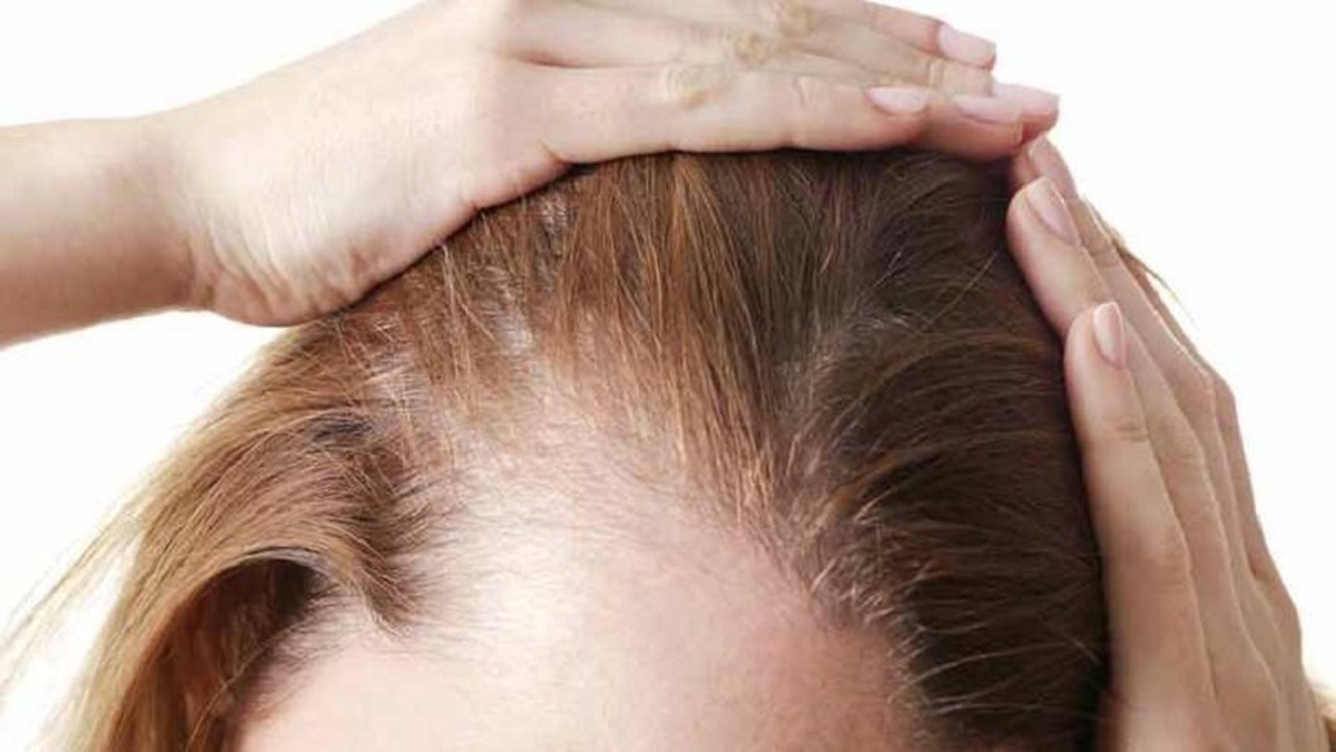 ۸ درمان طبیعی برای مو‌های نازک