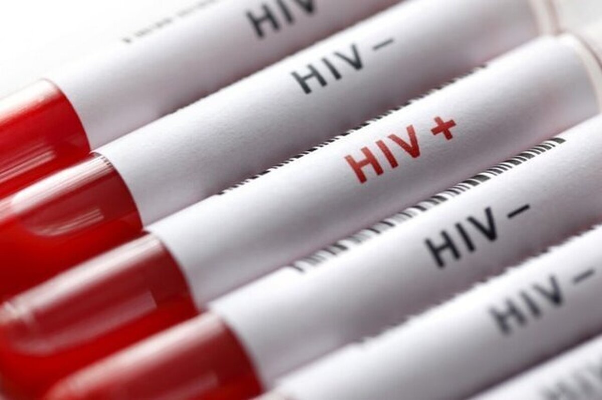 آخرین وضعیت بروز HIV در ایران