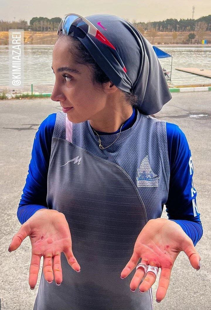 عکس| جراحت دست‌های دختر قایق‌سوار تیم ملی پس از یک تمرین سخت