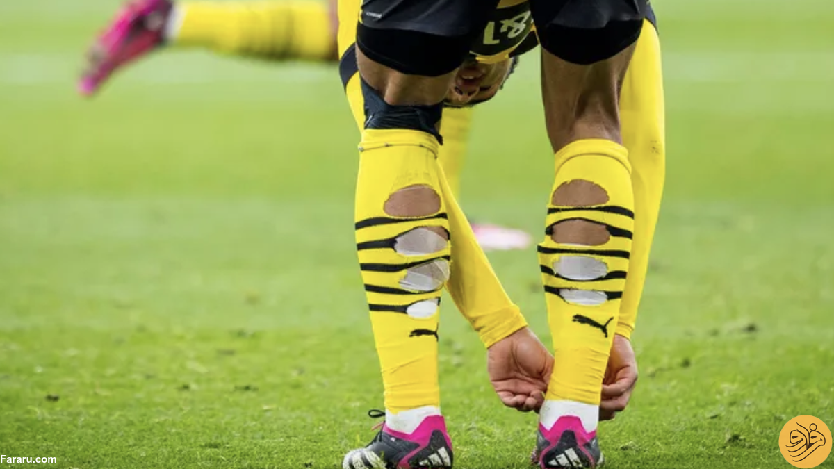 عکس| چرا بازیکنان فوتبال جوراب پاره می‌پوشند؟
