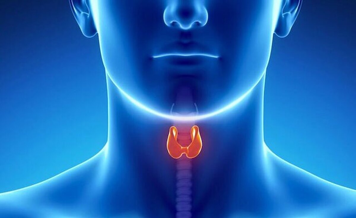 این افراد بیشتر در معرض ابتلا به پرکاری تیروئید هستند