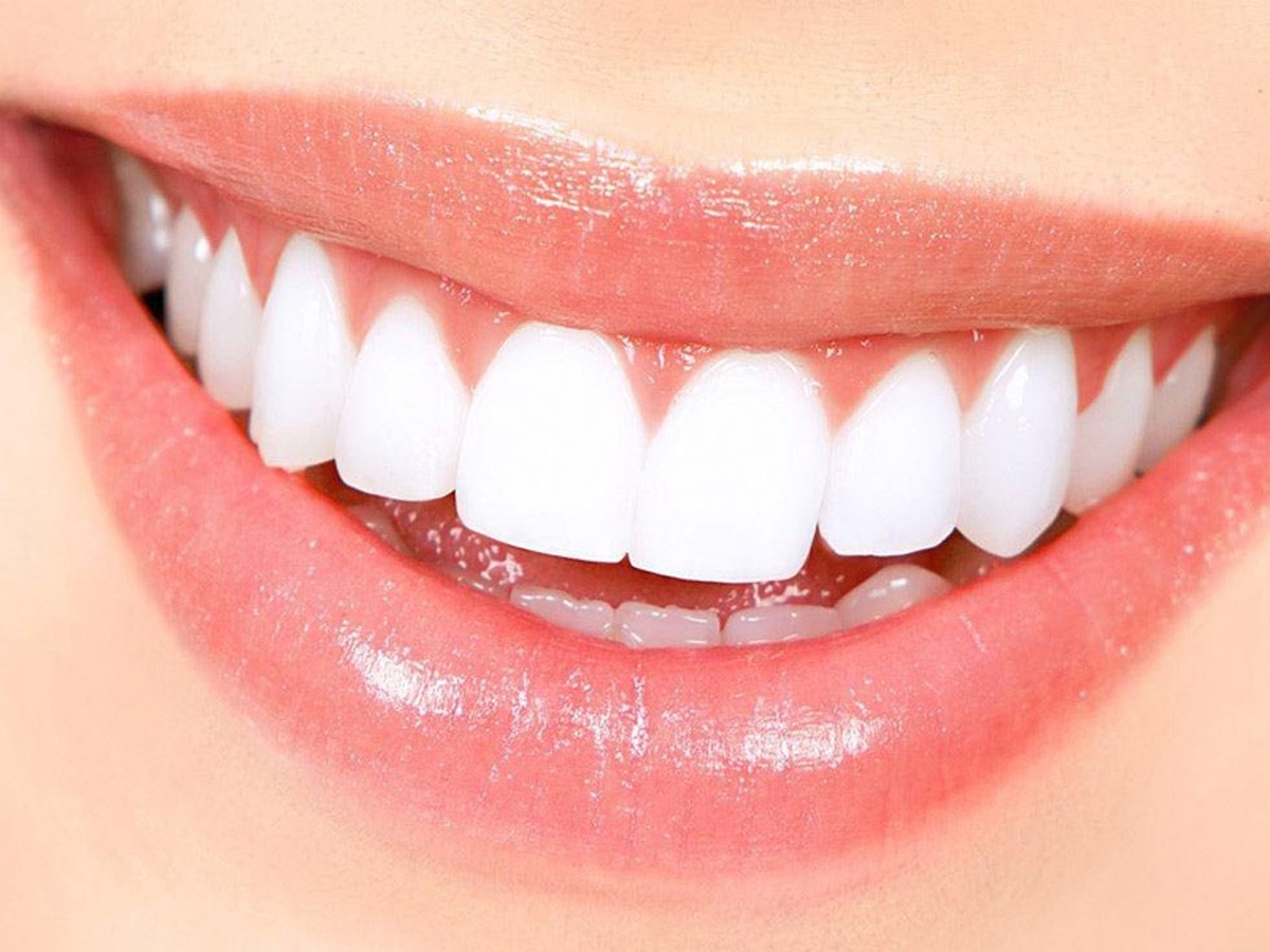 ۶ علت ساده در زرد شدن دندان‌ها