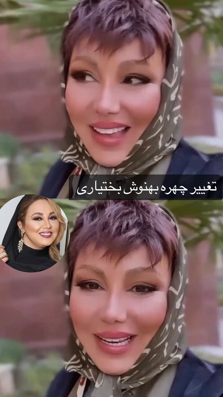 عکس| تغییر چهره لاغری عجیب بهنوش بختیاری پس از دوری از تلویزیون عکس| تغییر چهره لاغری عجیب بهنوش بختیاری پس از دوری از تلویزیون