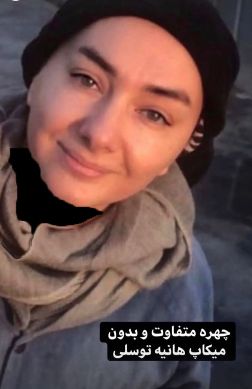 عکس| چهره داغون و شوکه کننده هانیه توسلی عکس| چهره داغون و شوکه کننده هانیه توسلی