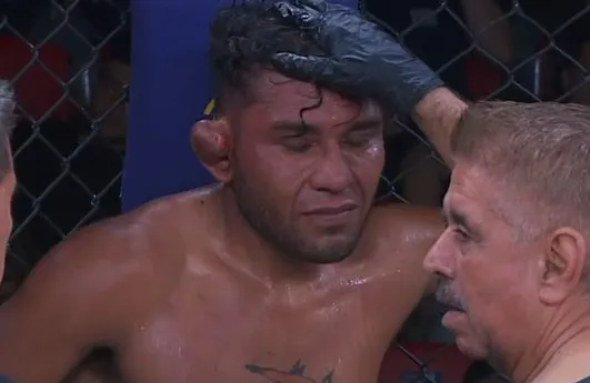 عکس| ترکیدن گوش مبارز MMA در اثر ضربه مشت حریف و پایان مبارزه! عکس| ترکیدن گوش مبارز MMA در اثر ضربه مشت حریف و پایان مبارزه!