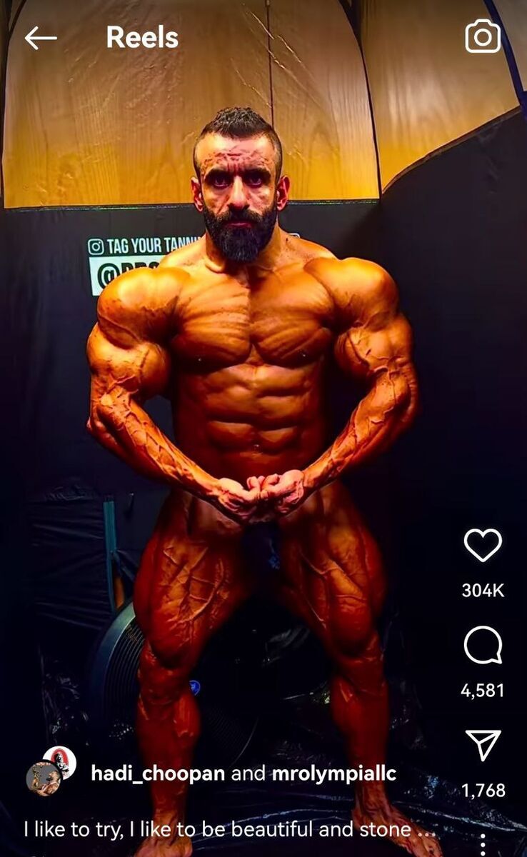 عکس| تاثیر تعطیلات عید نوروز روی بدن هادی چوپان عکس| تاثیر تعطیلات عید نوروز روی بدن هادی چوپان