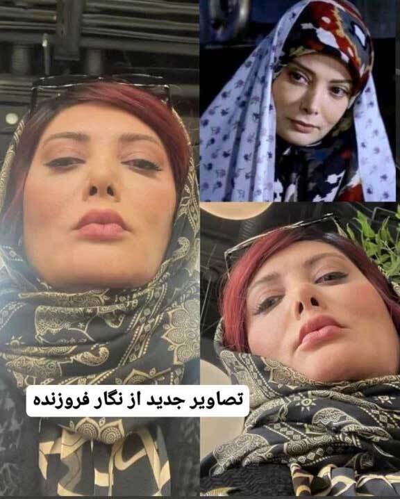 عکس| نگار فروزنده از چهره جدیدش رونمایی کرد
