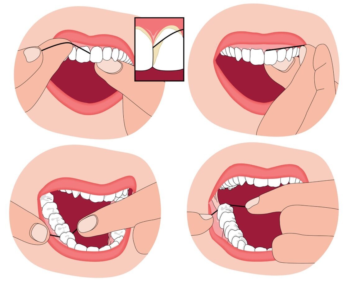 ۵ فایده نخ دندان/ چطور درست از نخ دندان استفاده کنیم؟ ۵ فایده نخ دندان/ چطور درست از نخ دندان استفاده کنیم؟