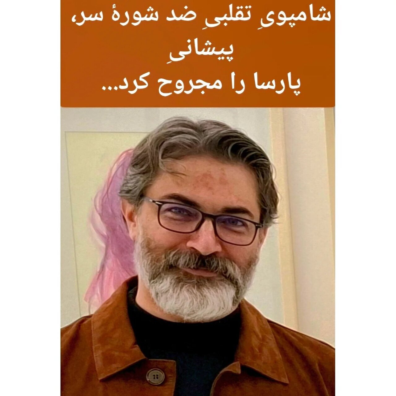 عکس/ بلایی که محصول تقلبی بر سر صورت پارسا پیروزفر آمد