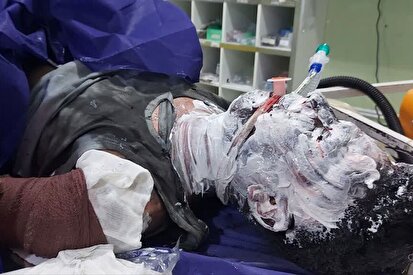 پایان تلخ چهارشنبه سوری با 21 کشته و 6419 مصدوم/ افزایش 23 درصدی مصدومان نسبت به پارسال