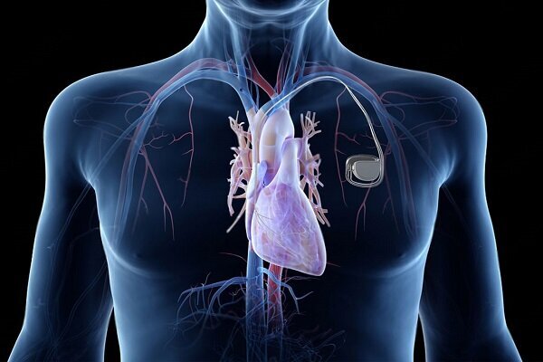 طراحی ضربان‌ساز قلبی که تا 300 سال در بدن کار می‌کند!