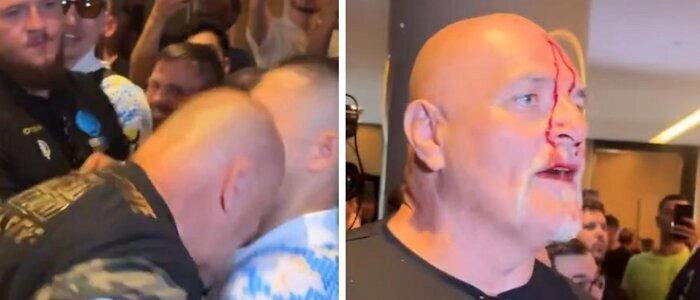 جنجال در ریاض؛ درگیری خونین پدر در دفاع از ستاره بوکس جهان + عکس جنجال در ریاض؛ درگیری خونین پدر در دفاع از ستاره بوکس جهان + عکس