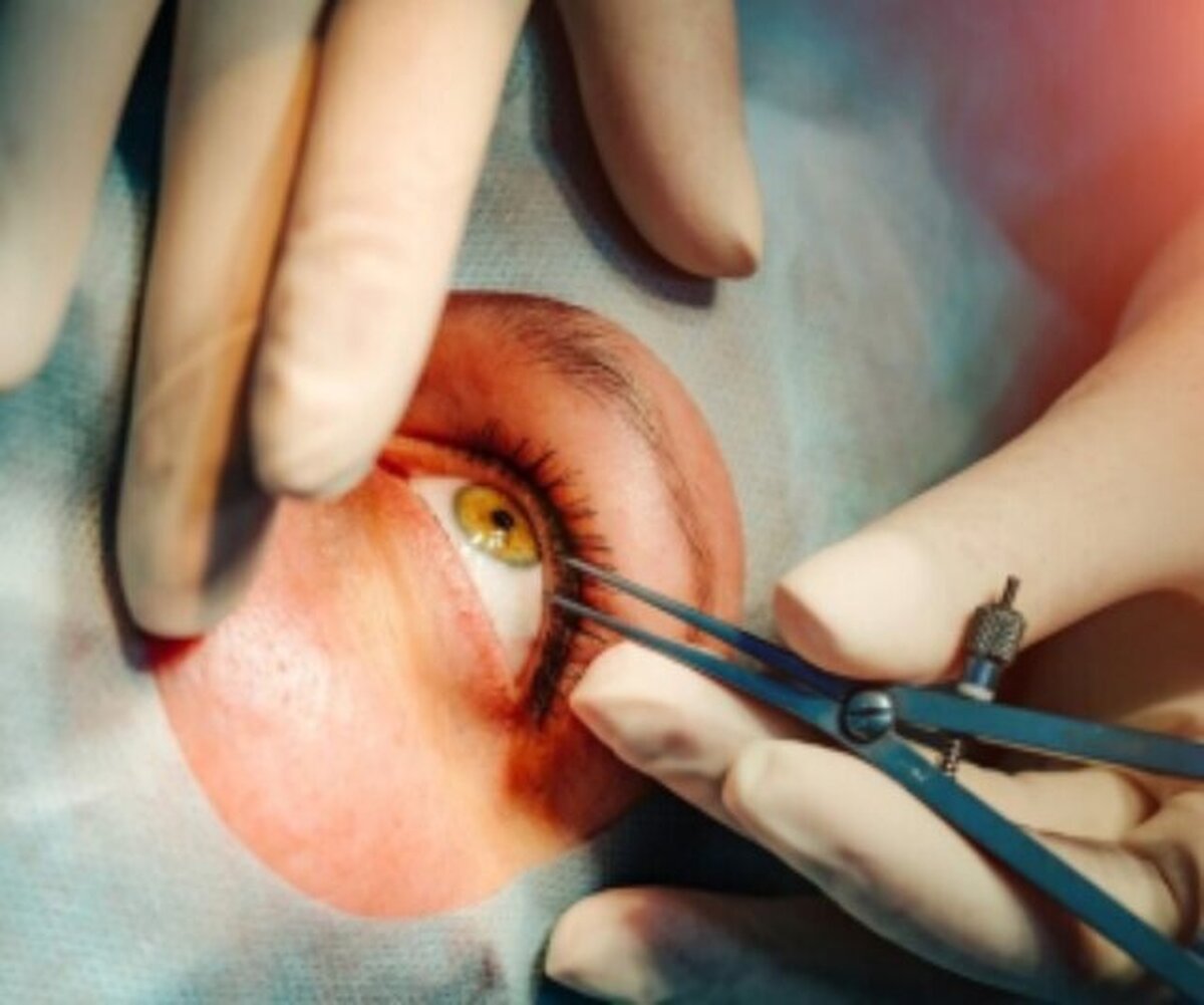 عملی که چشم سالم را معیوب می‌کند / خطر تغییر رنگ چشم برای افراد سالم