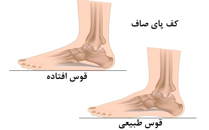 انواع بیماری‌های مربوط پا