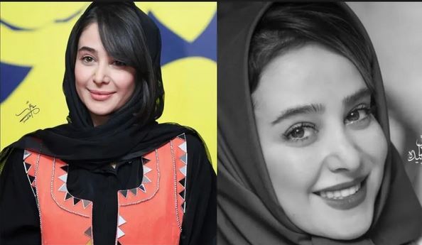 عکس/ عمل‌های زیبایی «الناز حبیبی» خبرساز شد