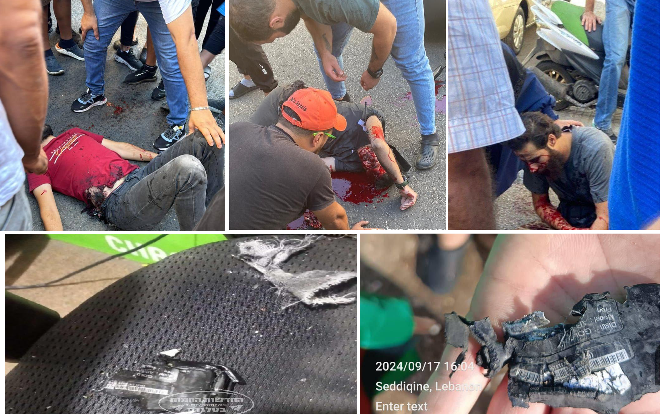 حمله گسترده اسرائیل به لبنان و سوریه و زخمی شدن صدها نفر| سفیر ایران مجروح شد حمله گسترده اسرائیل به لبنان و سوریه و زخمی شدن صدها نفر| سفیر ایران مجروح شد