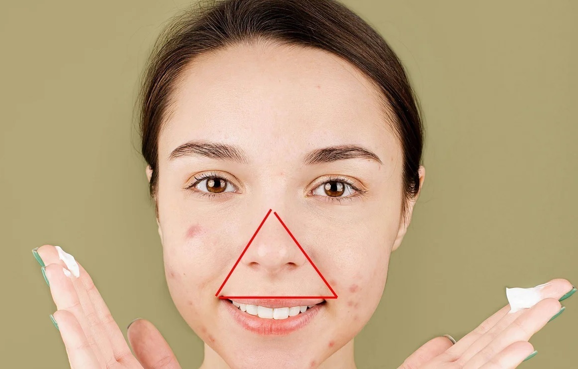 هیچوقت به جوشهای این ناحیه صورت دست نزنید هیچوقت به جوشهای این ناحیه صورت دست نزنید