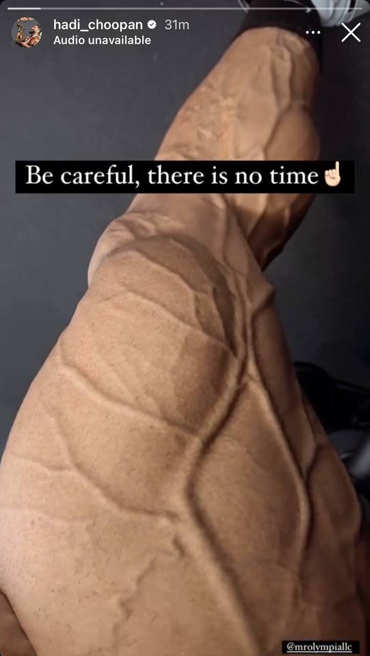 عکس/ رجزخواهی هادی چوپان برای رقبا؛ عضلات گرگ ایرانی