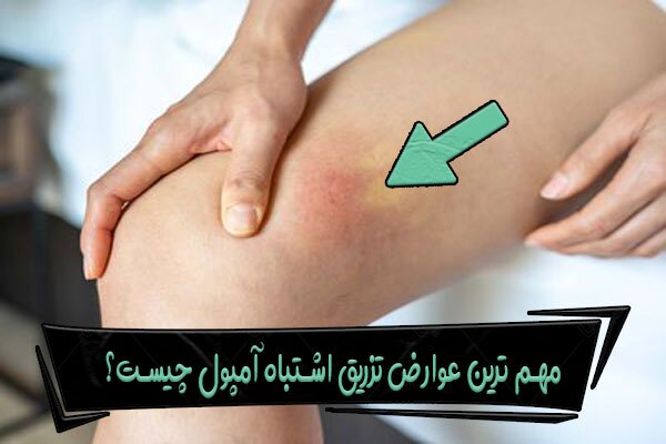 مهمترین عوارض تزریق اشتباه آمپول چیست؟ مهمترین عوارض تزریق اشتباه آمپول چیست؟