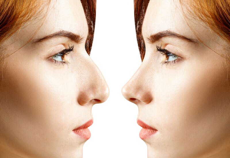 بهترین جراح بینی در تهران: چگونه متخصص مناسب را انتخاب کنیم؟ بهترین جراح بینی در تهران: چگونه متخصص مناسب را انتخاب کنیم؟