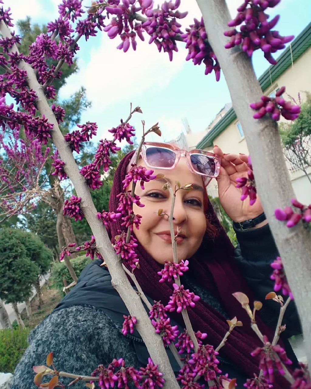 بازیگر زن محبوب دهه ۷۰ پس از مدتها آفتابی شد بازیگر زن محبوب دهه ۷۰ پس از مدتها آفتابی شد