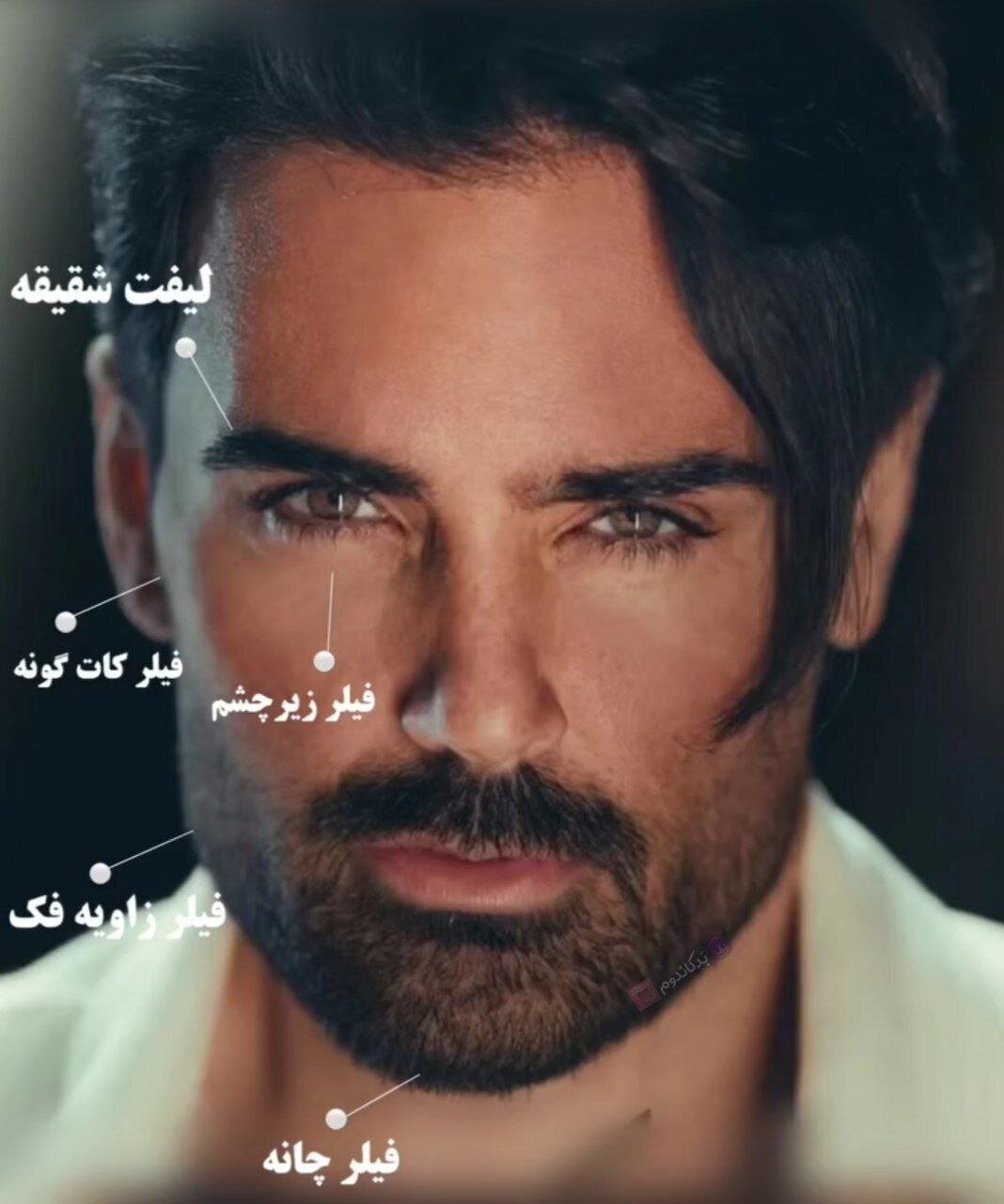 عکس/تغییرات اساسی خواننده پاپ بعد از عمل زیبایی!