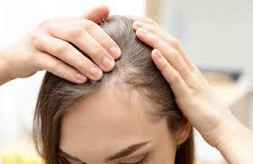 این اتفاقات ساده باعث ریزش موی شما می‌شود