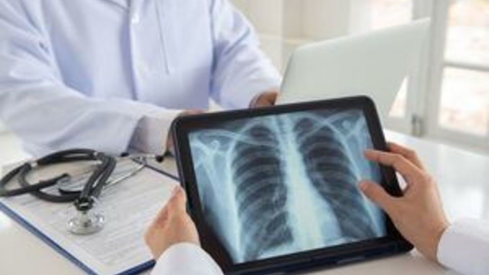 این بیماری‌ها باعث جمع شدن آب در ریه می‌شوند