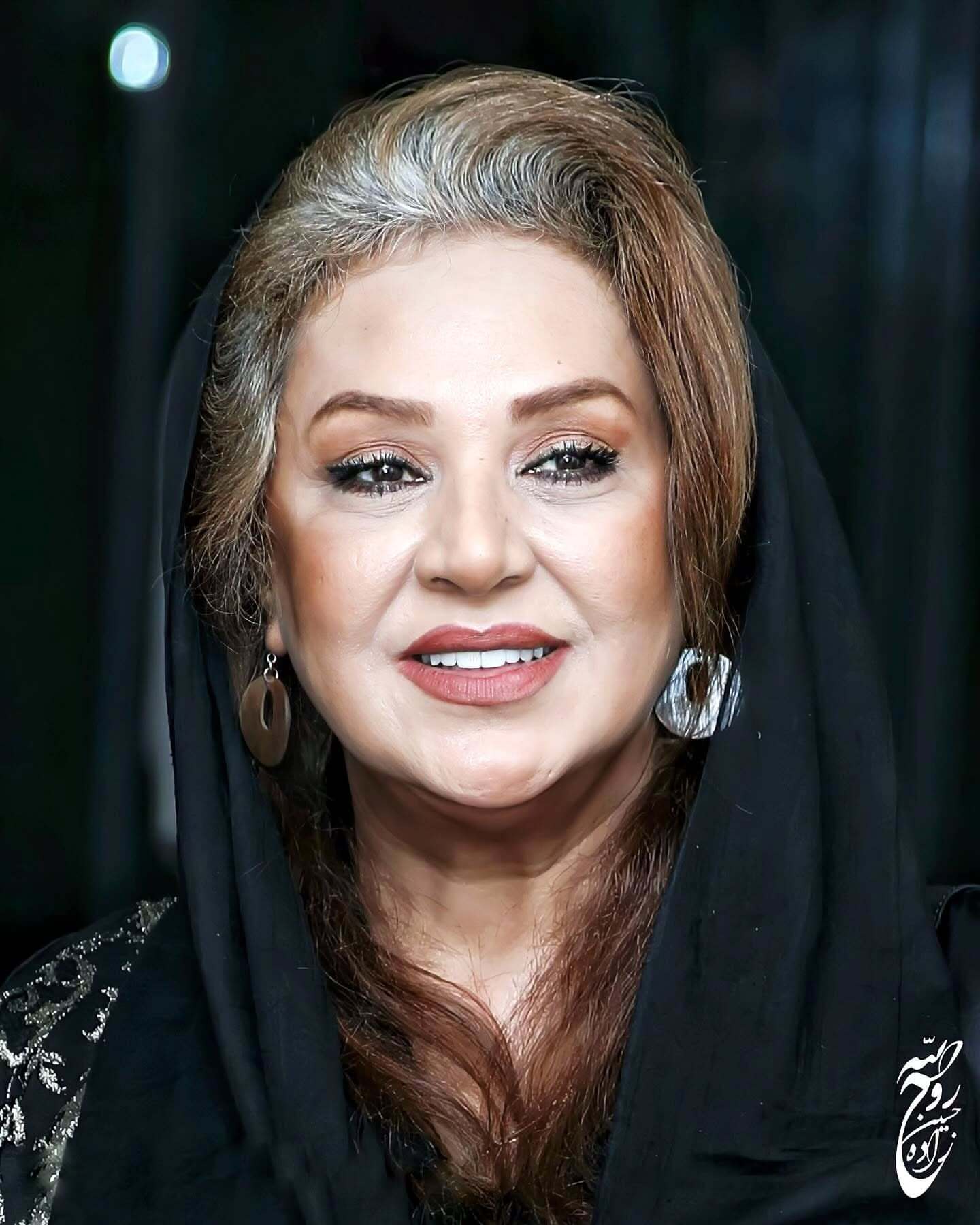 عکس/چهره شکسته‌شده نسرین مقانلو در عکس جدیدش