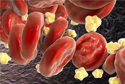 کاهش 49 درصدی «کلسترول بد» خون با ترکیب دو دارو