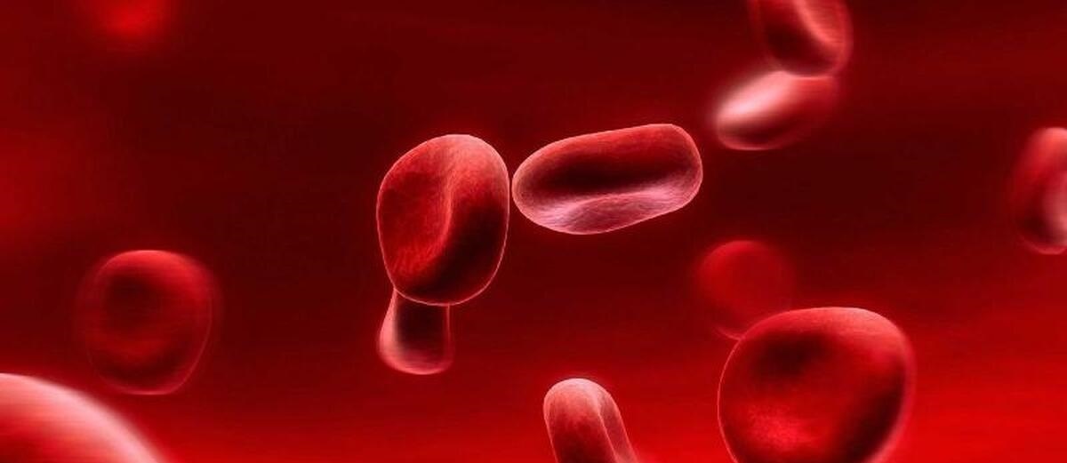 علائم بالا بودن کلسترول/ همه چیز را قبل از دیر شدن بدانید