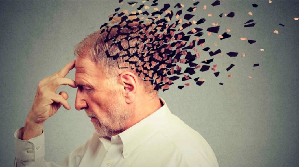 چشم‌ها، آینه‌ای از مغز؛ هشدار زودهنگام برای زوال عقل