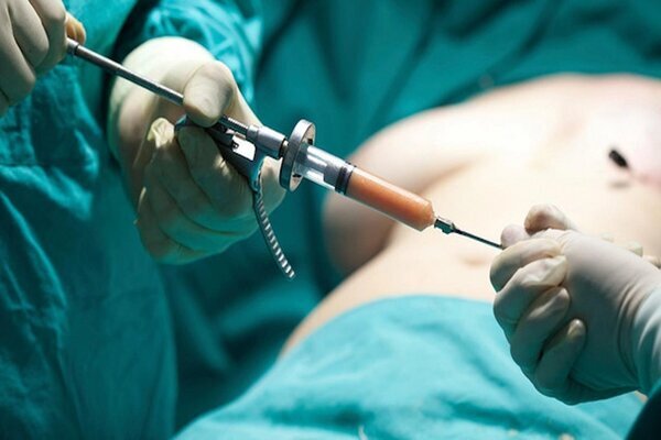 مضرات بوتاکس معده