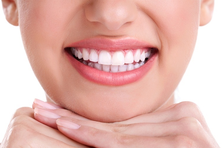 بلیچینگ دندان، راز لبخند جذاب تهرانیها! بلیچینگ دندان، راز لبخند جذاب تهرانیها!