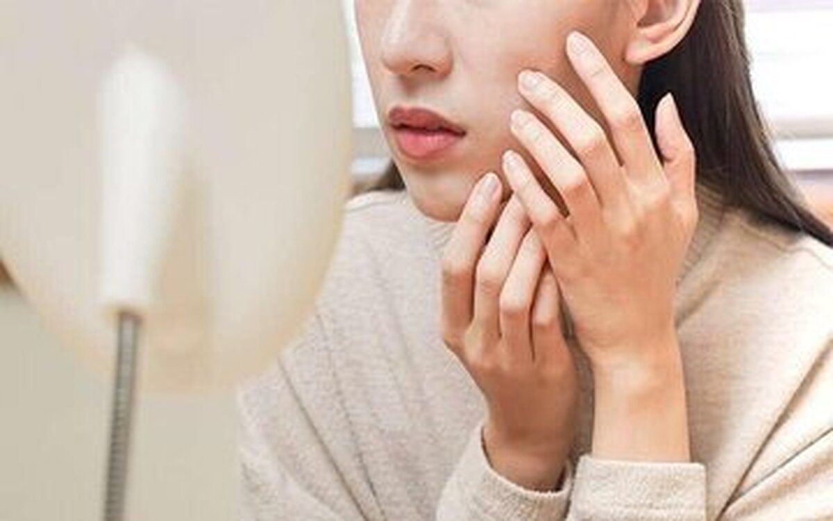 زیبایی پوست صورت به کمک طب سنتی