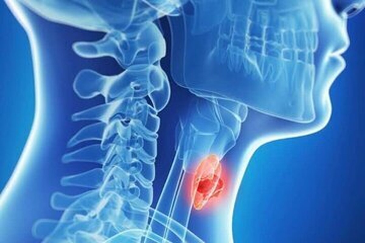 غذا‌های مفید برای کنترل تیروئید