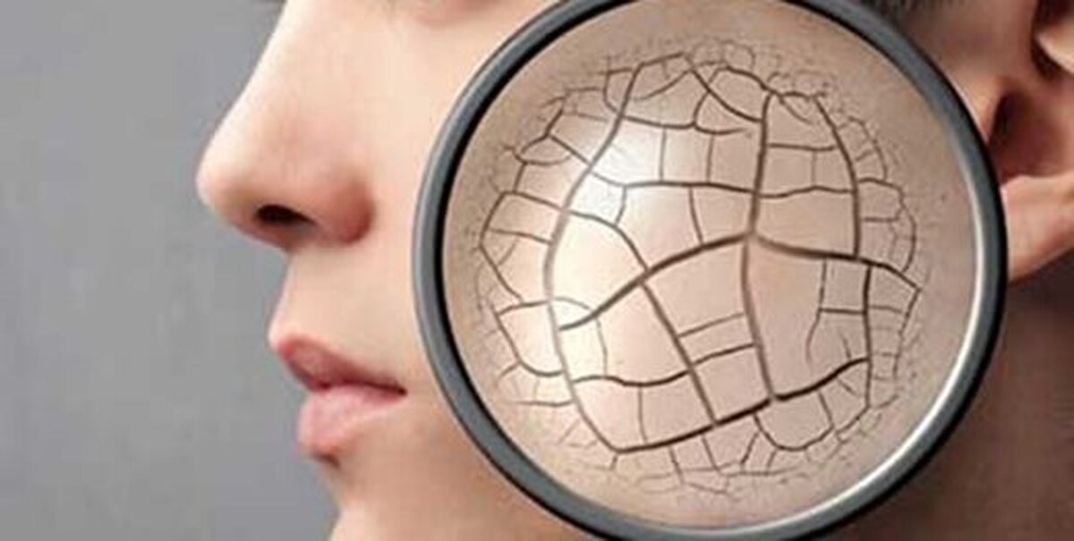 ۱۵ روش خانگی برای از بین بردن خشکی پوست