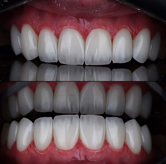 کامپوزیت لب شیشهای کامپوزیت لب شیشهای