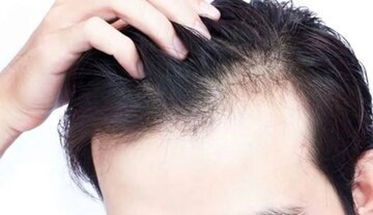 با چند خوراکی ساده از مو‌ها مراقبت کنیم