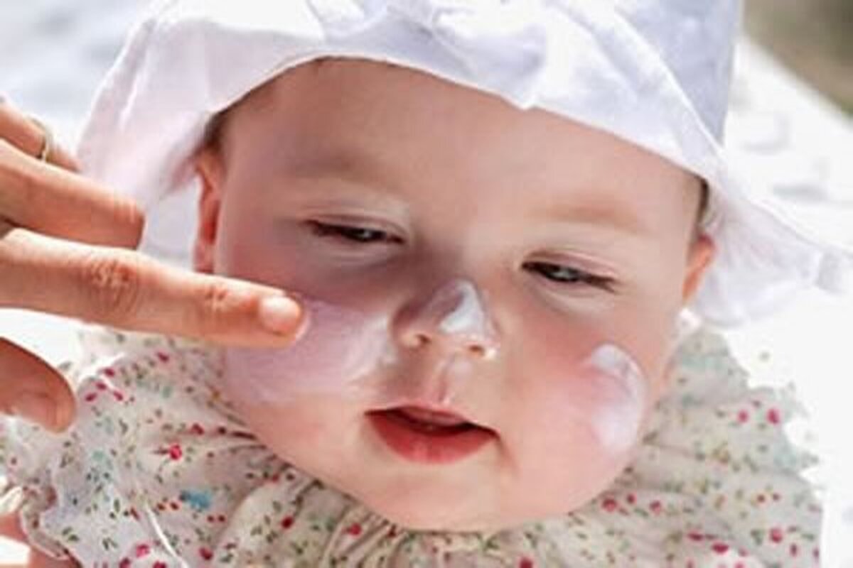 آفتاب سوختگی در کودکی، افزایش خطر ابتلا به سرطان پوست