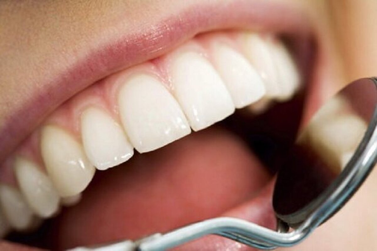 چه زمانی به متخصص ارتودنسی مراجعه کنیم؟