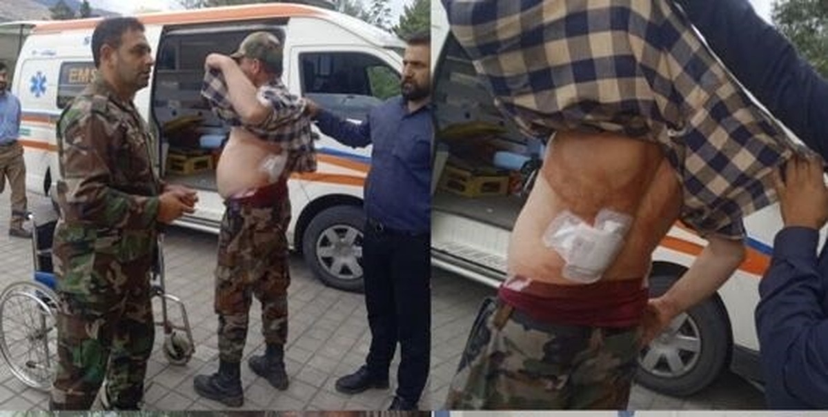 آخرین وضعیت جسمانی جنگلبان مجروح شده گیلانی