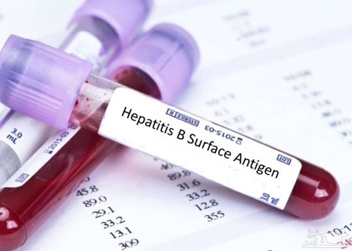در صورت درمان نشدن هپاتیت B یا C این بلا‌ها سر کبد می‌آید
