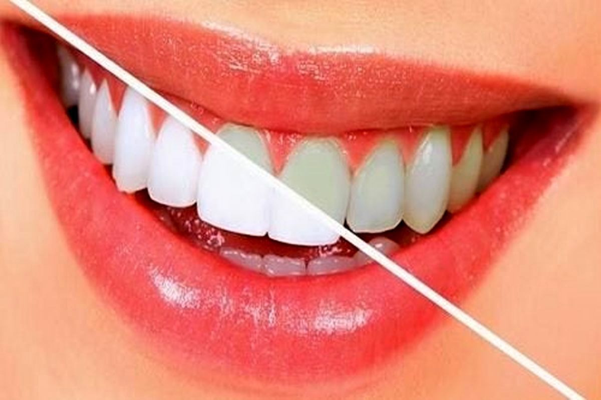 خوراکی‌هایی که مثل مسواک دندان هایتان را تمیز می‌کنند