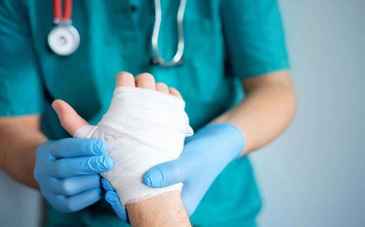 چند درصد سوختگی‌ها قابل پیشگیری هستند؟