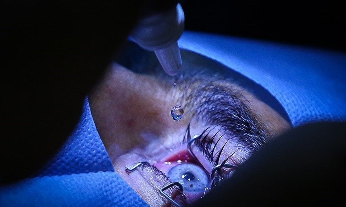 ردپای یک پزشک و مقام سابق مشهور در انجام جراحی تغییر رنگ چشم