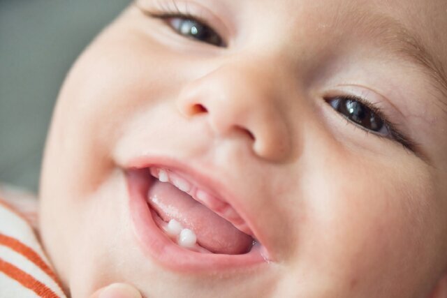 دندان‌ این نوزادان زودتر درمی‌آید